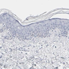 Immunohistochemical staining of human skin shows no positivity in squamous epithelial cells as expected.