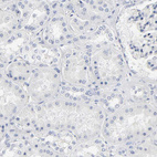 Anti-SLCO1B3 Antibody