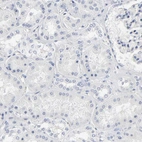 Immunohistochemical staining of human kidney shows no positivity in cells in tubules as expected.