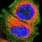 Immunofluorescent staining of human cell line A-431 shows localization to plasma membrane.