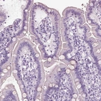 Immunohistochemical staining of human duodenum shows no positivity in glandular cells as expected.