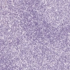 Immunohistochemical staining of human tonsil shows no positivity in non-germinal center cells as expected.