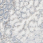 Immunohistochemical staining of human stomach shows low expression as expected.