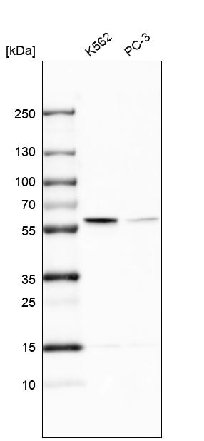 Anti-TROVE2 Antibody