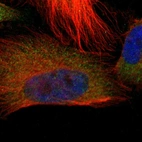 Immunofluorescent staining of human cell line U-251 MG shows localization to cytosol.