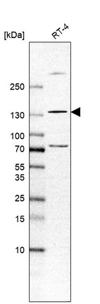 Anti-TYK2 Antibody