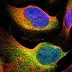 Immunofluorescent staining of human cell line U-2 OS shows localization to cytosol.