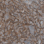 Anti-STAB1 Antibody