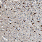 Immunohistochemical staining of human liver shows strong cytoplasmic positivity in endothelial cells.