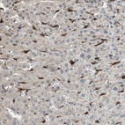 Immunohistochemical staining of human liver shows strong cytoplasmic positivity in endothelial cells.