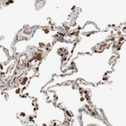 Immunohistochemical staining of human lung shows strong cytoplasmic positivity in macrophages.