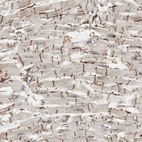 Immunohistochemical staining of human heart muscle shows strong cytoplasmic positivity in intercalated discs.