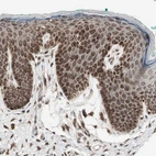 Immunohistochemical staining of human Skin shows strong nuclear and cytoplasmic positivity in squamous epithelial cells.