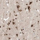 Immunohistochemical staining of human Cerebral cortex shows strong nuclear and cytoplasmic positivity in neuronal cells.