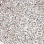 Immunohistochemical staining of human Liver shows very weak nuclear and cytoplasmic positivity in hepatocytes.
