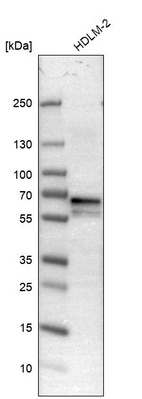 Western blot analysis in human cell line HDLM-2.