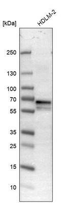 Western blot analysis in human cell line HDLM-2.