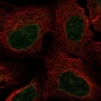 Immunofluorescent staining of human cell line U-2 OS shows localization to nuclear membrane.