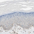 Immunohistochemical staining of human skin shows low expression as expected.