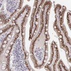 Immunohistochemical staining of human small intestine shows high expression.