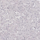 Immunohistochemical staining of human liver shows low expression as expected.