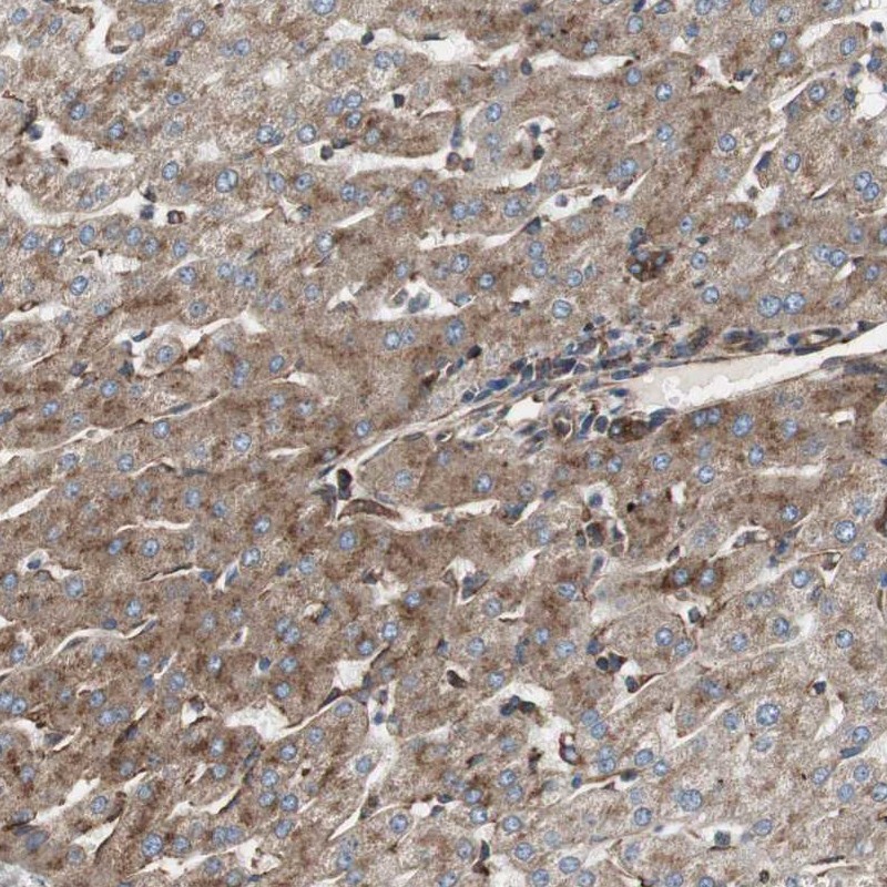 Anti-H6PD Antibody