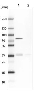 Lane 1: NIH-3T3 cell lysate (Mouse embryonic fibroblast cells)_br/_Lane 2: NBT-II cell lysate (Rat Wistar bladder tumour cells)