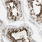 Anti-TULP4 Antibody