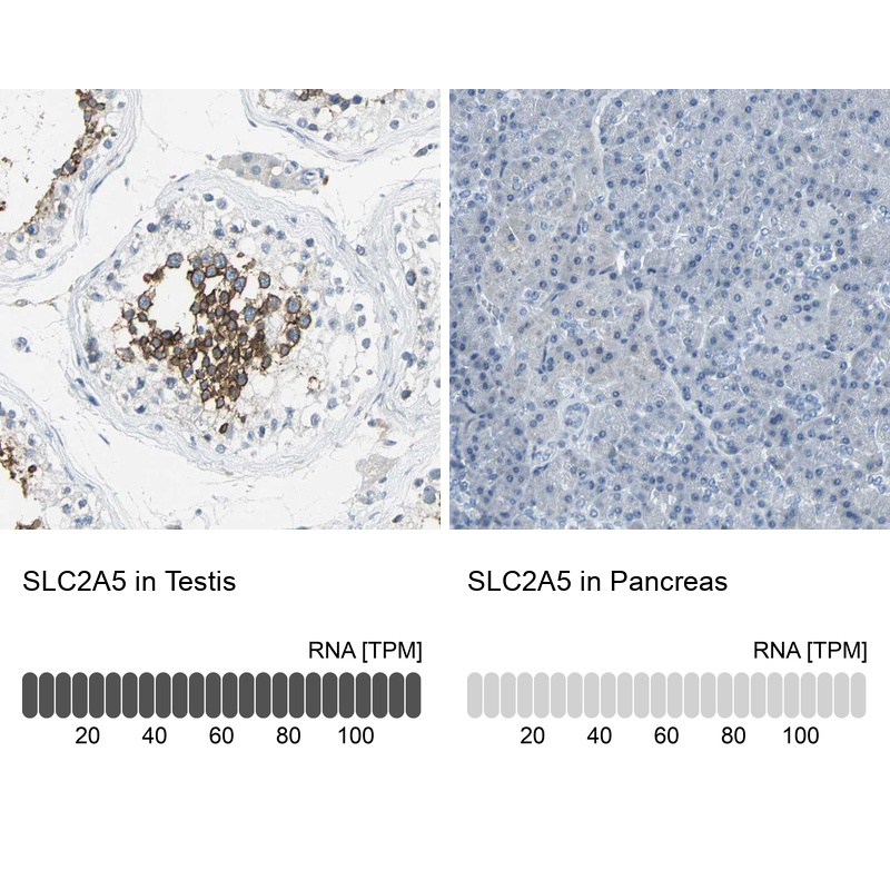 Anti-SLC2A5 Antibody