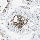 Immunohistochemical staining of human testis shows strong membranous positivity in cells in seminiferous ducts.