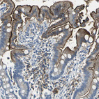 Anti-SLC2A5 Antibody