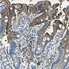 Immunohistochemical staining of human duodenum shows strong positivity in apical membrane in glandular cells.