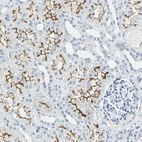 Immunohistochemical staining of human kidney shows strong positivity in luminal membrane in cells in tubules.