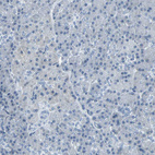 Anti-SLC2A5 Antibody