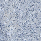 Immunohistochemical staining of human pancreas shows no positivity in exocrine glandular cells as expected.
