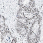 Anti-ARID1A Antibody