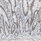 Immunohistochemical staining of human duodenum shows moderate nuclear positivity in glandular cells.