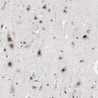 Immunohistochemical staining of human cerebral cortex shows moderate to strong nuclear positivity in neuronal cells.