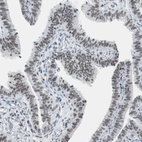 Immunohistochemical staining of human fallopian tube shows moderate nuclear positivity in glandular cells.