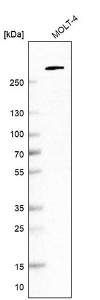 Western blot analysis in human cell line MOLT-4.