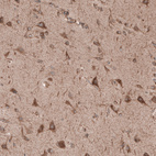 Immunohistochemical staining of human cerebral cortex shows positivity in neurons.