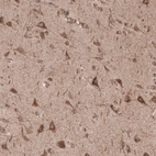 Immunohistochemical staining of human cerebral cortex shows positivity in neurons.