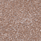 Immunohistochemical staining of human liver shows positivity in hepatocytes.