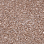 Immunohistochemical staining of human liver shows positivity in hepatocytes.