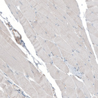 Immunohistochemical staining of human skeletal muscle shows very weak positivity in myocytes.