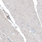 Immunohistochemical staining of human skeletal muscle shows very weak positivity in myocytes.