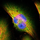 Immunofluorescent staining of human cell line U-251 MG shows localization to cytosol & vesicles.