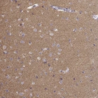 Immunohistochemical staining of human cerebral cortex shows high expression.