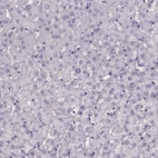 Immunohistochemical staining of human liver shows low expression as expected.