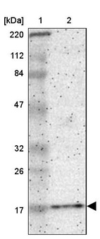 Lane 1: Marker [kDa] 220, 112, 84, 47, 32, 26, 17_br/_Lane 2: Human cell line RT-4